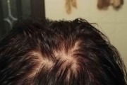 狗狗咖啡因中毒（了解如何保护你的宠物不受咖啡因的伤害）